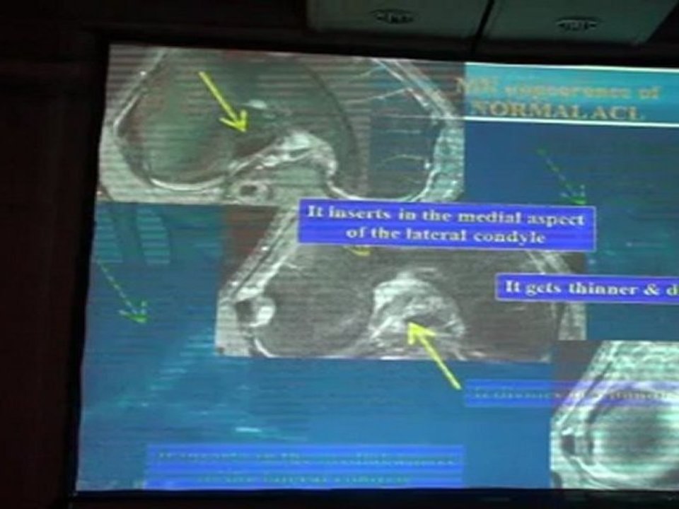 BELLAICHE Traumatic Knee Basics in MRI