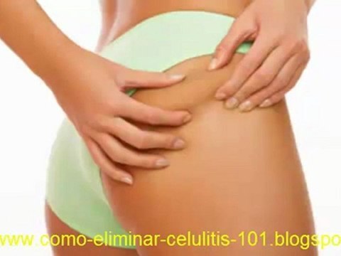 Celulitis - Como quitar la celulitis ya - Tratamiento Natural Para Eliminar Celulitis