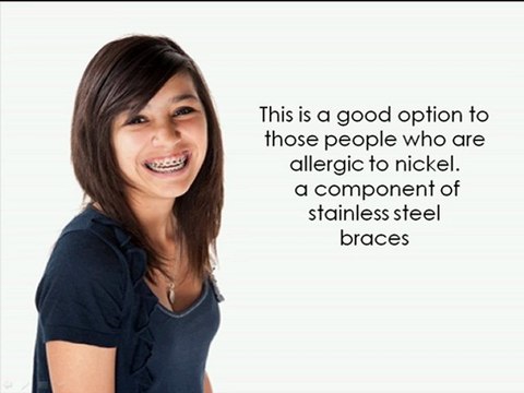 Gold Braces Orthodontist Grand Rapids