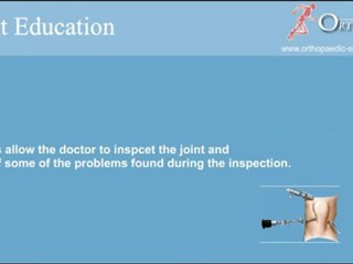 knee Arthroscopy India