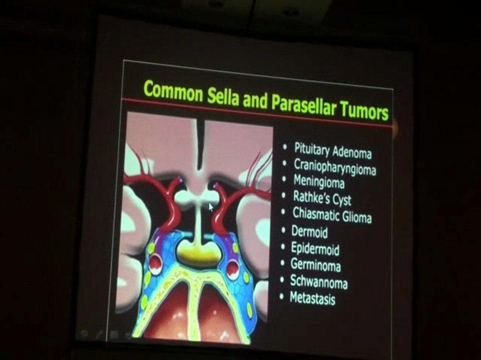 DAITZCHMAN Brain Tumors