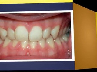 Orthodontics Parker CO Nov2011