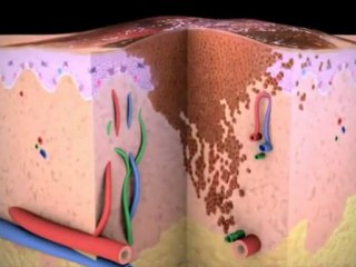 Understanding Cancer: How It Spreads 🧬