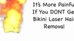 Hair Laser Removal in Los Angeles - Bikini Hair Removal LA