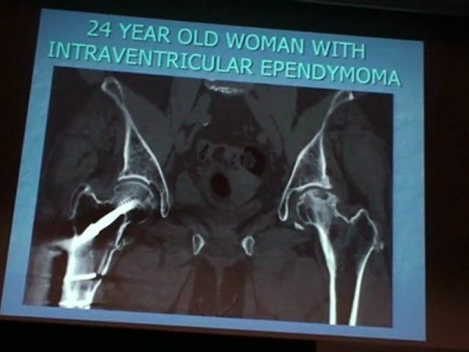 MILITIANU Adult hip pain imaging