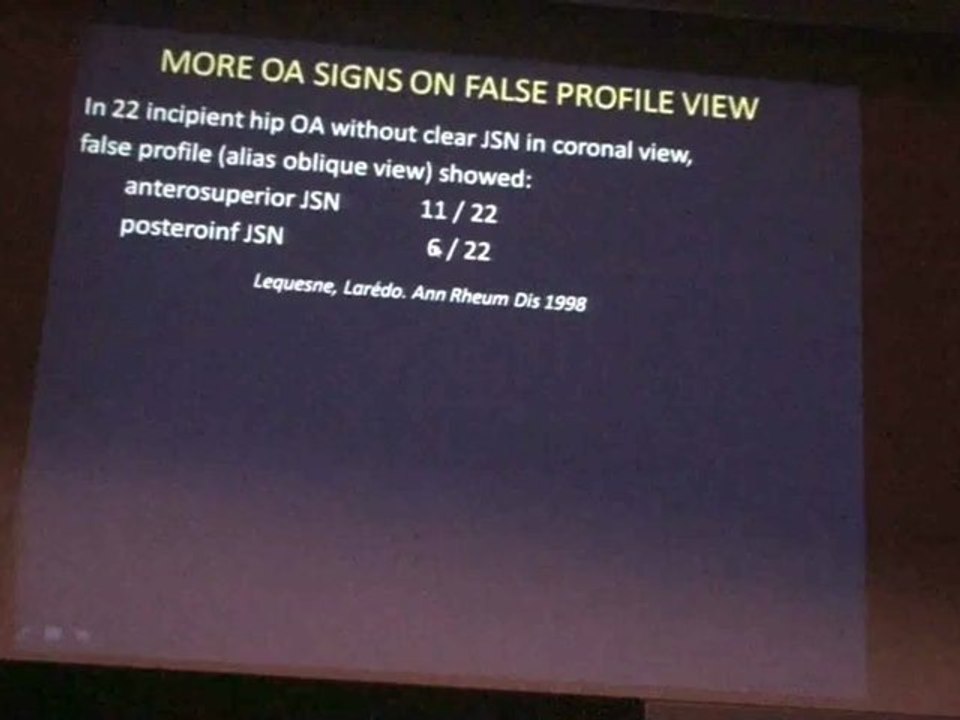 LEQUESNE Hip Osteoarthritis Relevant views Careful reading