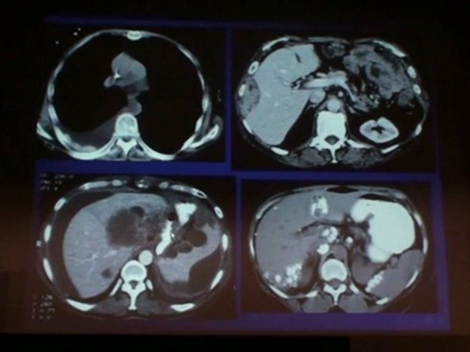 HILLER CT IN GYNECOLOGY 2011