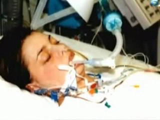 MDMA: Riesgo hepatico