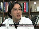 Vedere il cancro a occhio nudo: rivoluzione dal Giappone