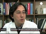 Un espray para identificar células con cáncer