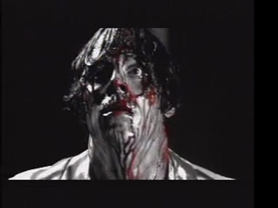 Metric - Monster Hospital