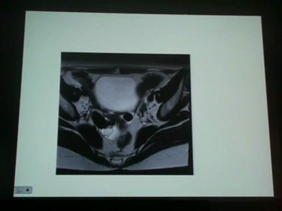MILLISCHER-BELLAICHE FEMALE PELVIS IMAGING CASES 2011