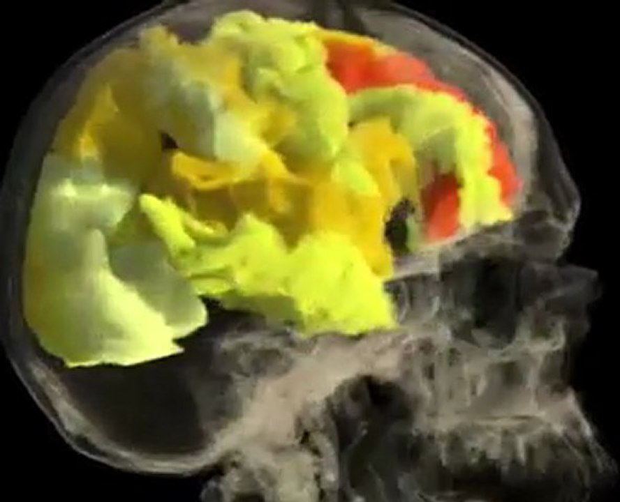Dailymotion - Female Brain Orgasm Video - a Life   Style video