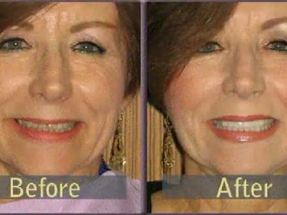 Holistic Dentist Seattle | Mercury Free Dentistry | Dr. Paul Rubin DDS