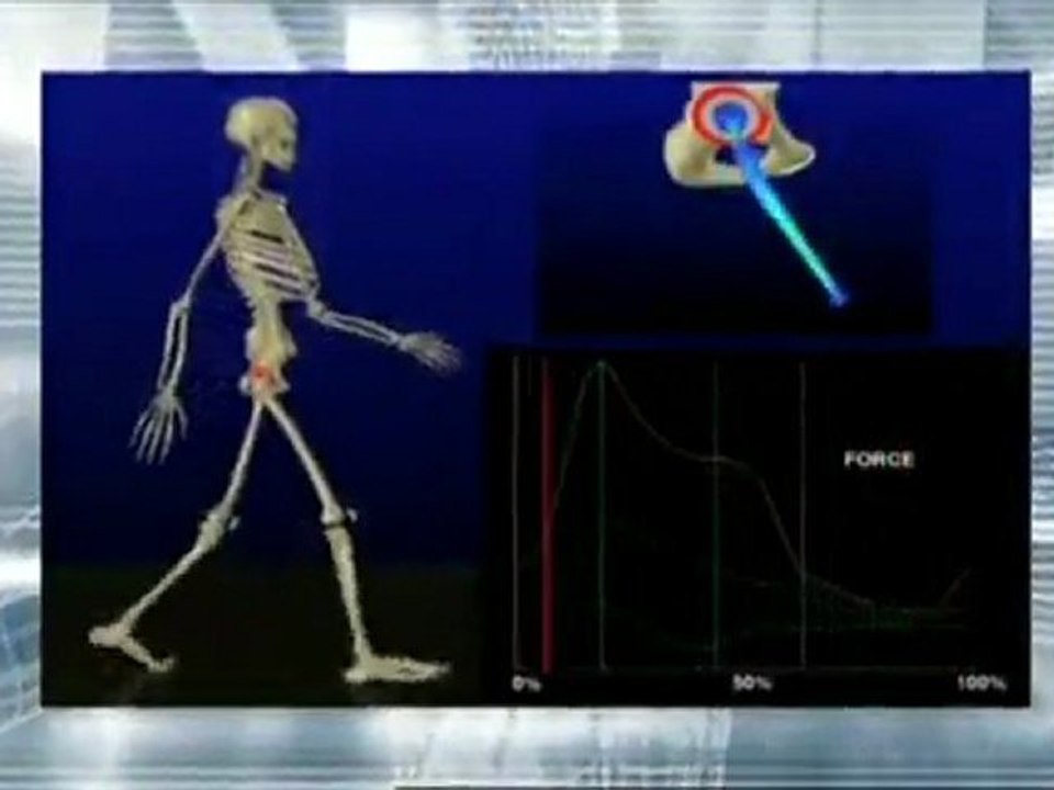 yürüme ve hareket sistemi mucizesi=İnsan vücudunun hareketli ana iskelesi Omurga