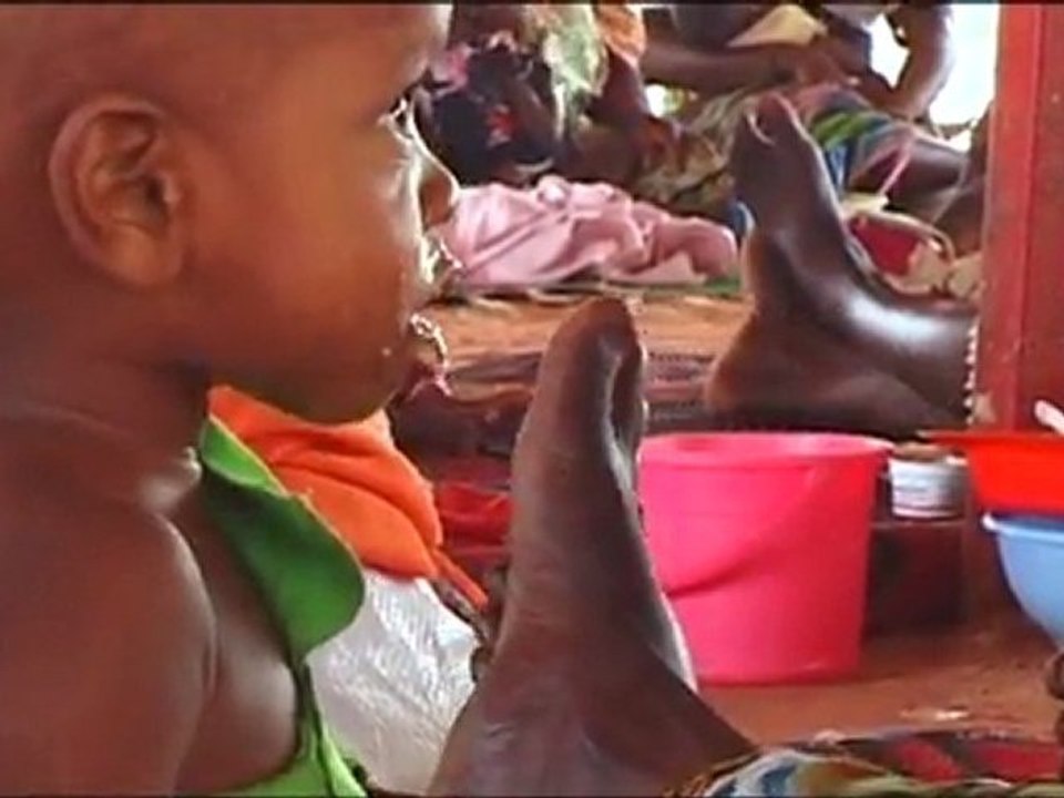 Historique 2007 Malnutrition
