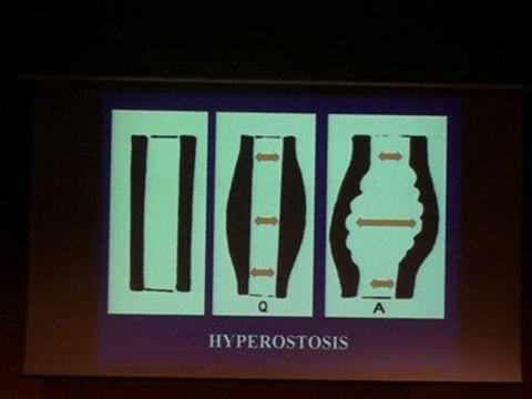 LAREDO BONE PSEUDO TUMORS Part 2 2010