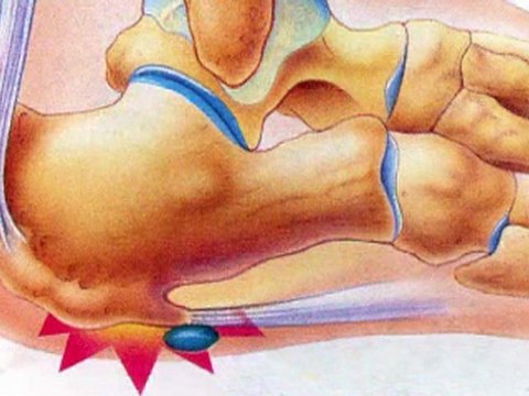 Heel Pain - Podiatrist, Manahawkin, Barnegat, Little Egg Harbor, NJ