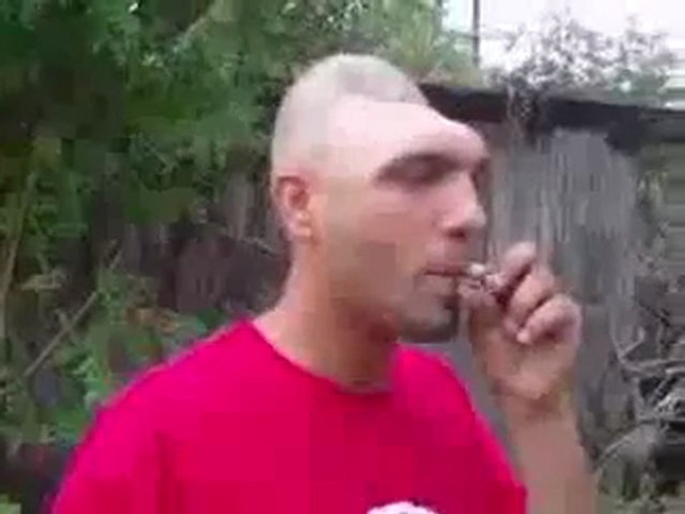 0413 - Homme au crâne enfoncé
