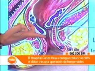 Como combatir la hemorroides