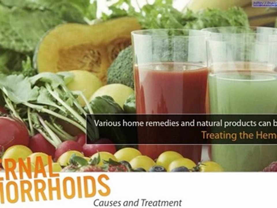 Internal Hemorrhoids: Causes and Treatment