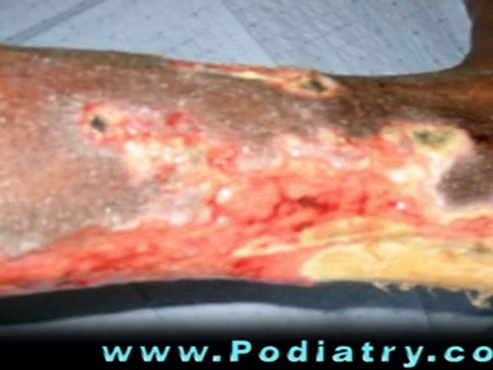 Podiatry CME | Prof. Andrew Boulton @ Desert Foot