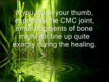 Basal Joint Arthritis
