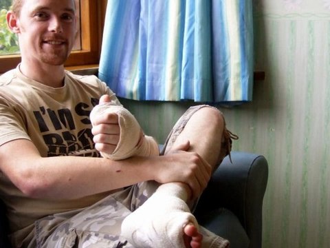 James Byrne et son gros orteil à la main