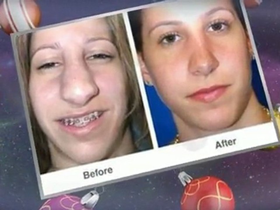 Get Nose Beautification by Best Plastic Surgeon Las Vegas- Dr. Troell