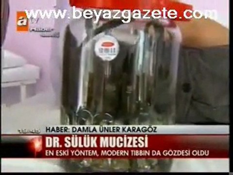 sülük satışı ankara,sülük istanbul,sülük Bursa ,izmir,SÜLÜK,SÜLÜKLER, SÜLÜKÇÜ