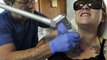 tattoo removal methods - home tattoo removal - how to remove a tattoo without laser