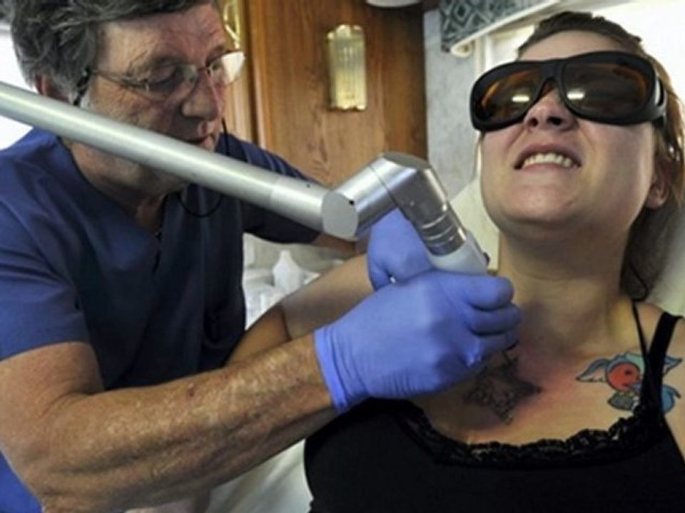 tattoo removal methods - home tattoo removal - how to remove a tattoo without laser