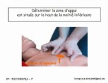 Arrêt Cardio Respiratoire (ACR)