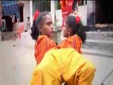 spider girls (conjoined twins)  - YouTube