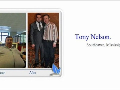 Gastric Sleeve Surgery San Antonio