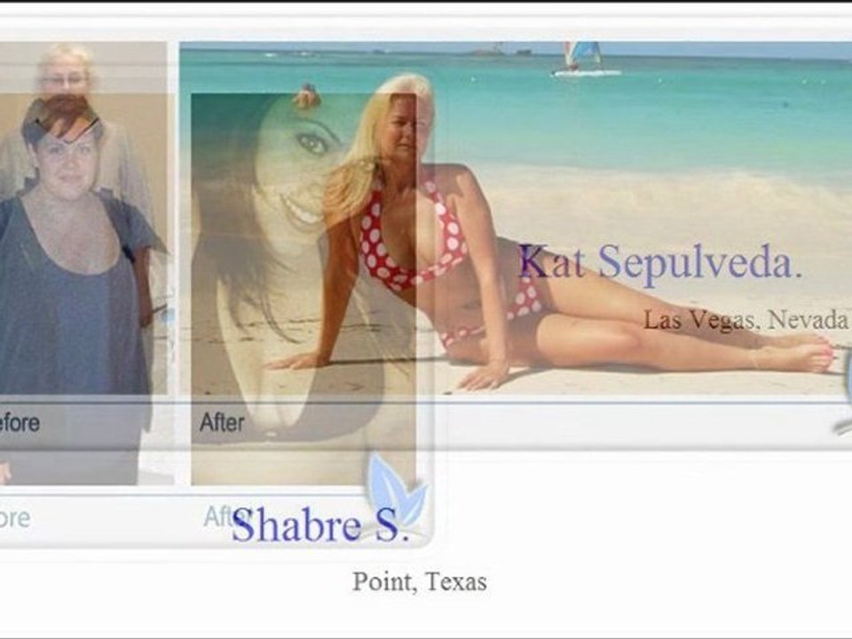 Weight Loss Surgeon San Antonio TX