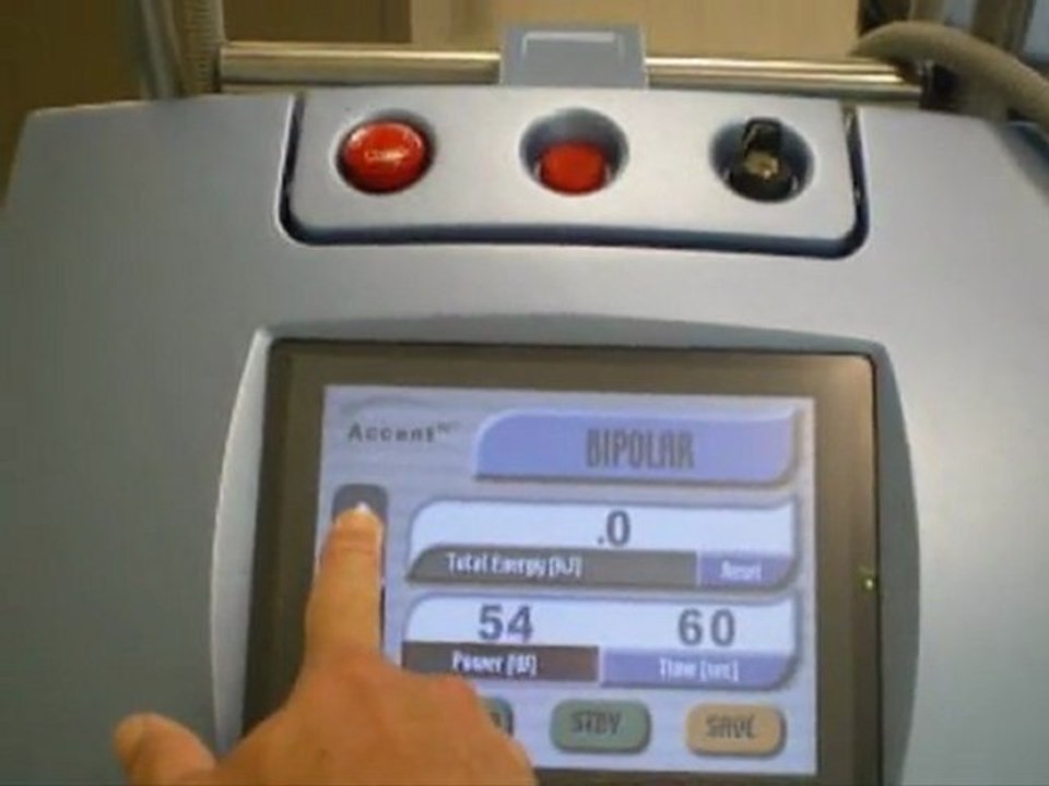 2007 Alma Accent XL Radio Frequency Laser