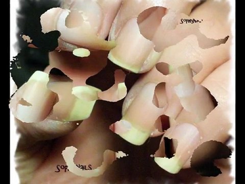 Les ongles tachés Sophy Nails