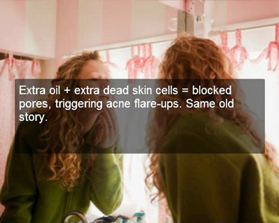Get Rid Acne When Following These Ideas