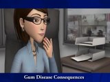 Gum Disease Consequences, Children Dentist West Hollywood CA, Implant Dentist 90068, 90069