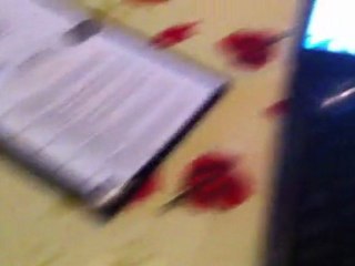 problème csr élite