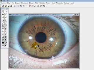 IRIDOLOGIA CEDIPS.com.mx  | Aprenda cómo insertar mapas topologicos usando Irisearch pro