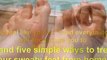 excess sweating treatment - sweaty feet treatment - sweaty hands treatment