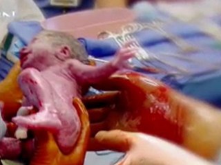 The Powell Quints Three Years Later - CBN.com