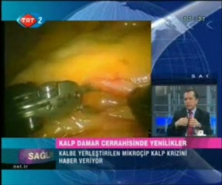 Sağlık Olsun - Kalp ve Damar Cerrahisi 16.04.2009