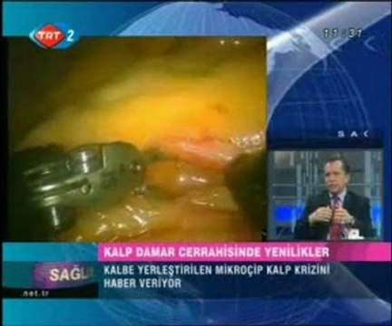 Sağlık Olsun - Kalp ve Damar Cerrahisi 16.04.2009