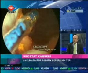 Sağlık Olsun - Prostat Kanseri 14.05.2009