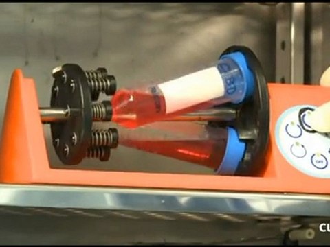 Estudio con células madre adultas en fístulas por enfermedad de Crohn