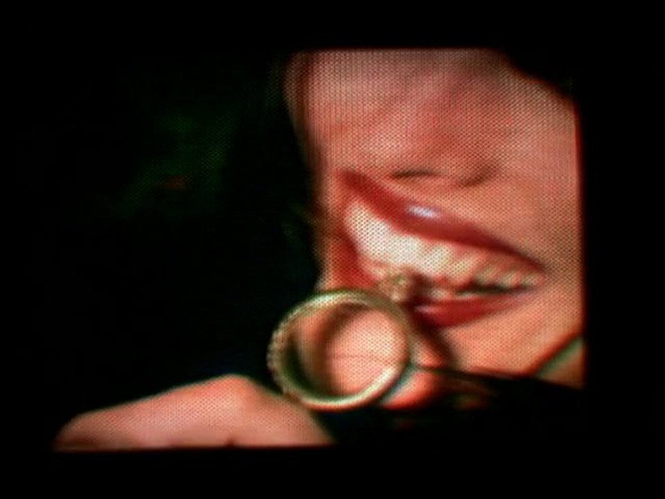 мaѕѕιve aттacĸ - ιnerтιa creepѕ