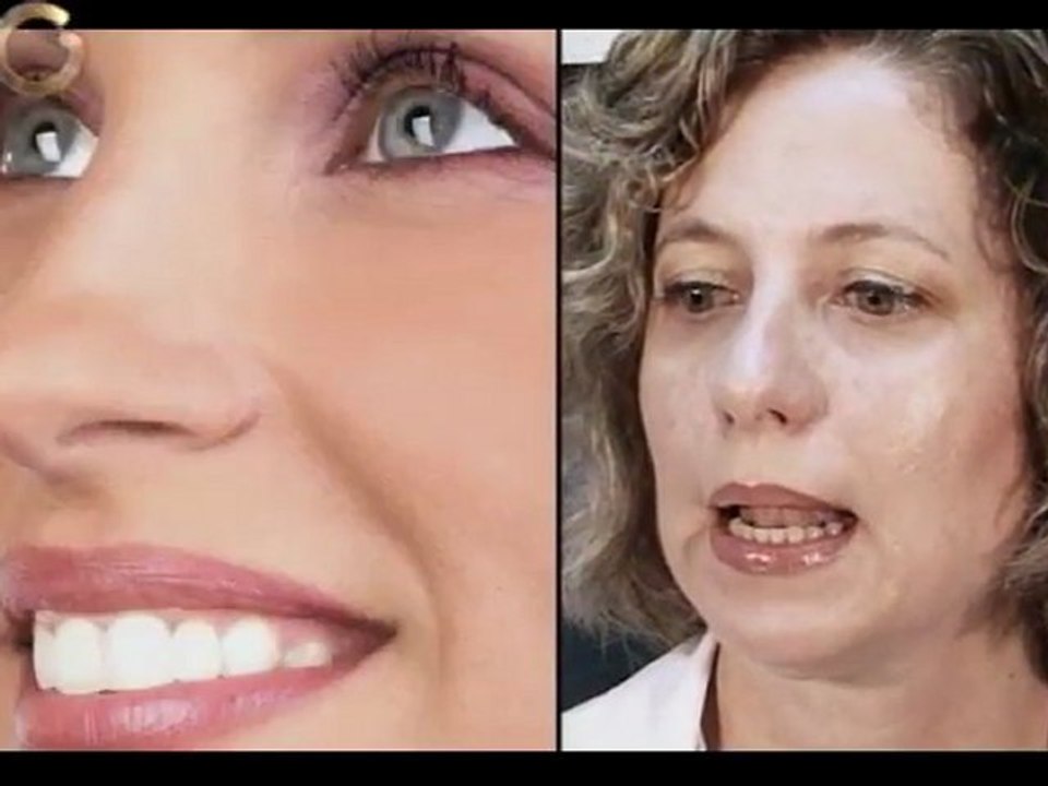 Mitos de la cirugía estética